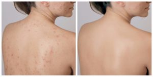 tác dụng của xơ mướp 