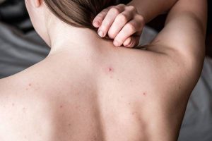 Xà bông cục trị mụn lưng