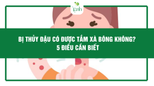 bị thủy đậu có được tắm xà bông không