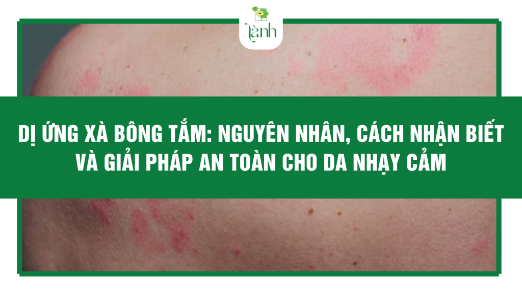 Dị Ứng Xà Bông Tắm: Nguyên Nhân, Cách Nhận Biết và Giải Pháp An Toàn Cho Da Nhạy Cảm