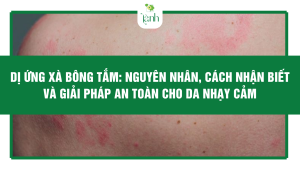 Dị Ứng Xà Bông Tắm: Nguyên Nhân, Cách Nhận Biết và Giải Pháp An Toàn Cho Da Nhạy Cảm