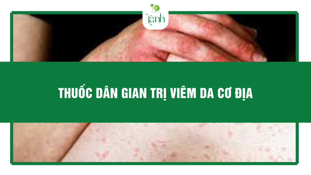 thuốc dân gian trị viêm da cơ địa