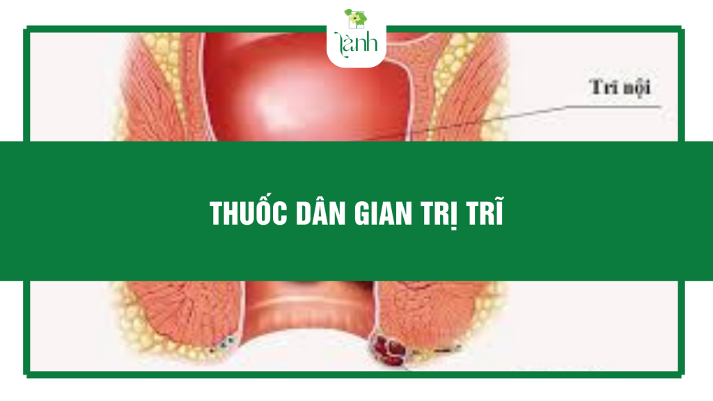 thuốc dân gian trị trĩ