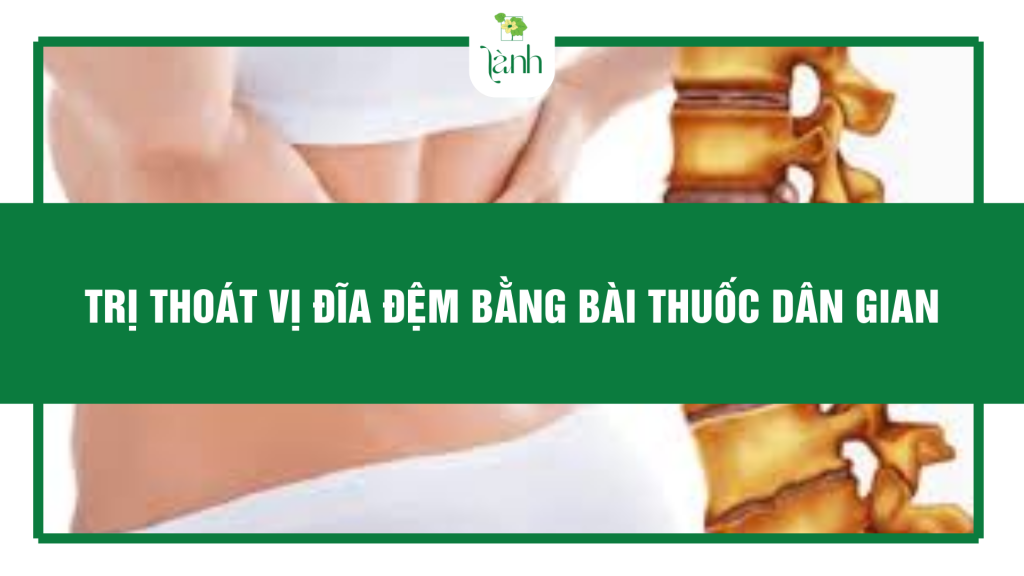 trị thoát vị đĩa đệm bằng bài thuốc dân gian