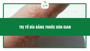trị tổ đỉa bằng thuốc dân gian