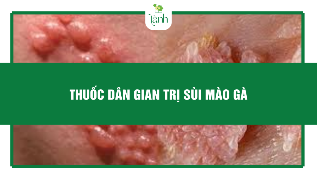 thuốc dân gian trị sùi mào gà