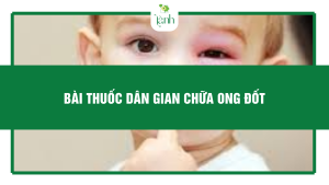 bài thuốc dân gian chữa ong đốt