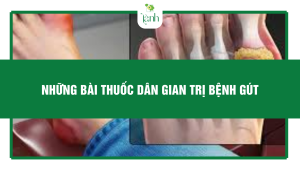 những bài thuốc dân gian trị bệnh gút